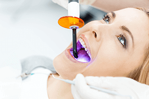 Teeth Whitening Treatment In Vista